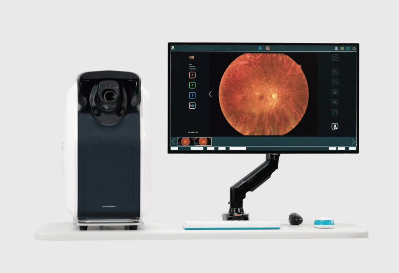 Ultra wide-field fundus camera